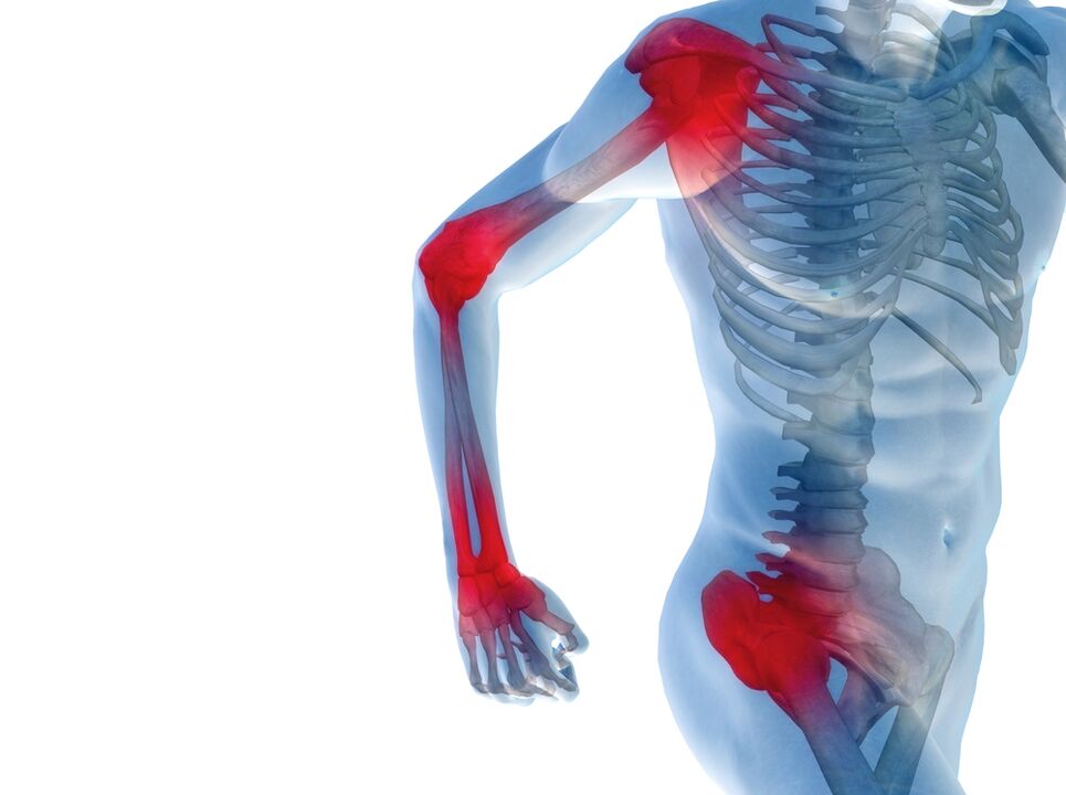 Pain in the joints of the arms and legs. 
