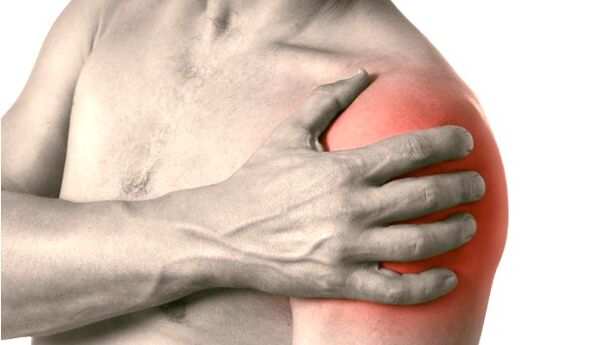 A swollen, red, enlarged shoulder symptoms of osteoarthritis of the shoulder joint grade 2-3