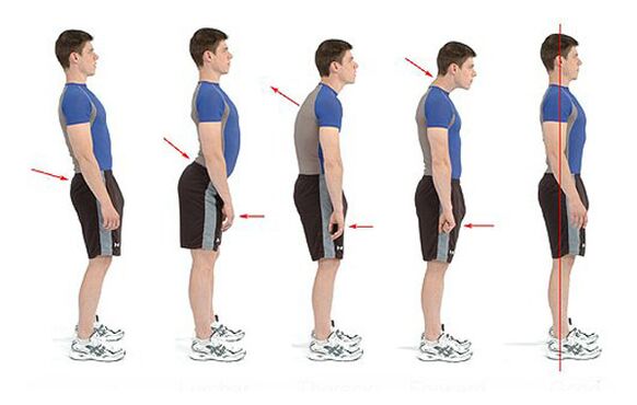 Osteochondrosis prevention