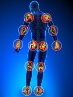 Location of the joints affected by osteoarthritis