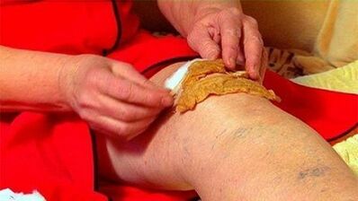 Compresses for the osteoarthritis of the knee joint