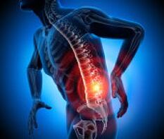 various causes of back pain