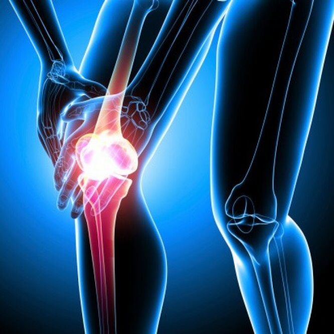 Late-stage rheumatoid arthritis can cause hip pain